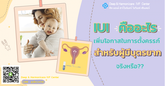 IUI คืออะไร