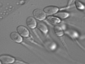 IMSI high-magnification sperm selection