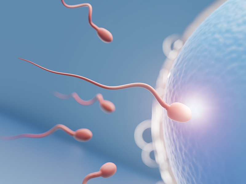 Intrauterine Insemination (IUI) procedure