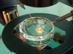 ICSI procedure for IVF treatment