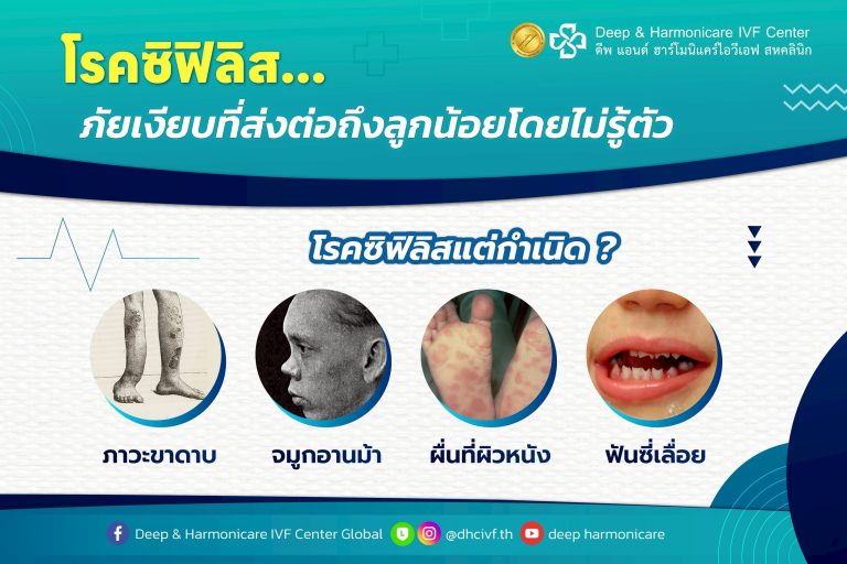 Article_ซิฟิลิสแต่กำเนิด